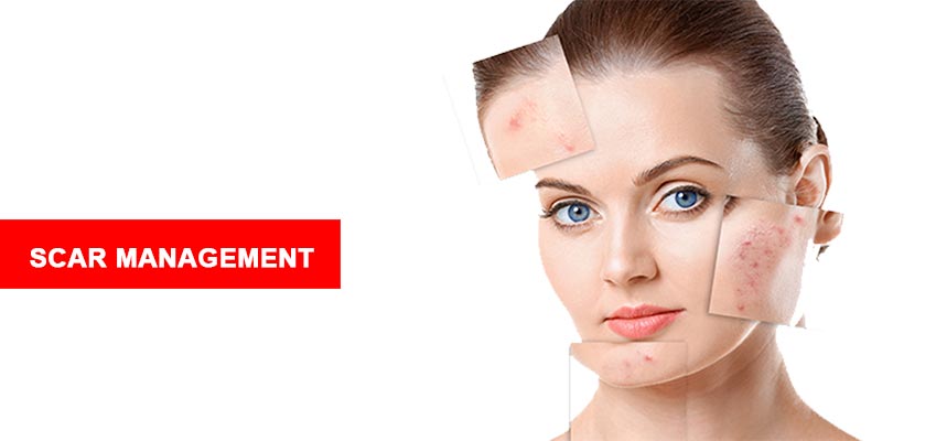 Scar Removal Treatment In Jaipur